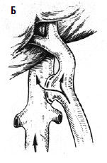 Коллектив авторов - Избранные лекции по факультетской хирургии: учебное пособие