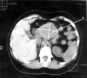 Коллектив авторов - Избранные лекции по факультетской хирургии: учебное пособие