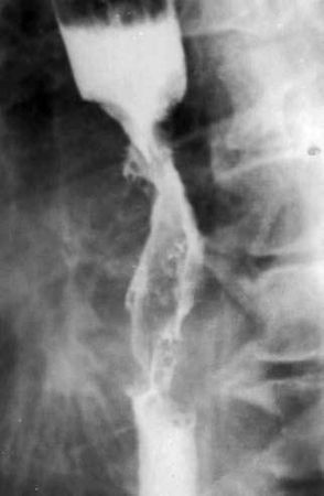 Коллектив авторов - Избранные лекции по факультетской хирургии: учебное пособие