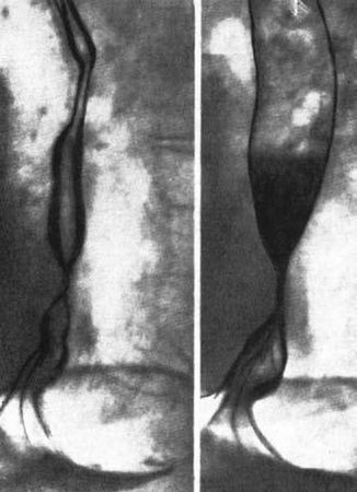 Коллектив авторов - Избранные лекции по факультетской хирургии: учебное пособие