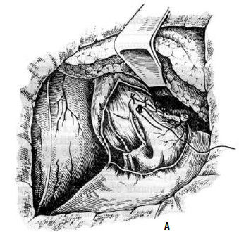 Коллектив авторов - Избранные лекции по факультетской хирургии: учебное пособие