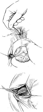 Коллектив авторов - Избранные лекции по факультетской хирургии: учебное пособие