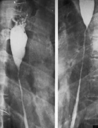 Коллектив авторов - Избранные лекции по факультетской хирургии: учебное пособие