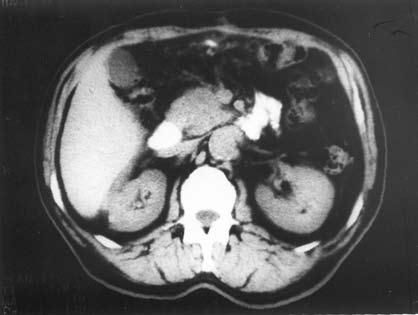 Коллектив авторов - Избранные лекции по факультетской хирургии: учебное пособие