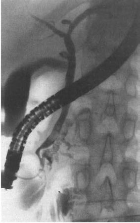 Коллектив авторов - Избранные лекции по факультетской хирургии: учебное пособие
