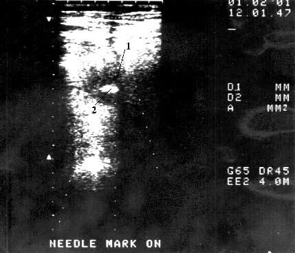 Коллектив авторов - Избранные лекции по факультетской хирургии: учебное пособие