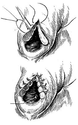 Коллектив авторов - Избранные лекции по факультетской хирургии: учебное пособие
