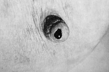 Коллектив авторов - Избранные лекции по факультетской хирургии: учебное пособие