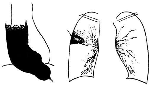 Коллектив авторов - Избранные лекции по факультетской хирургии: учебное пособие