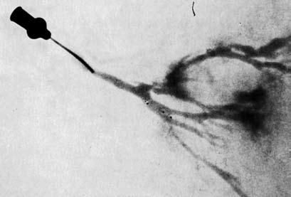 Коллектив авторов - Избранные лекции по факультетской хирургии: учебное пособие