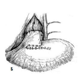 Коллектив авторов - Избранные лекции по факультетской хирургии: учебное пособие