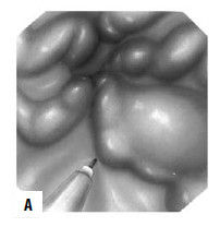 Коллектив авторов - Избранные лекции по факультетской хирургии: учебное пособие
