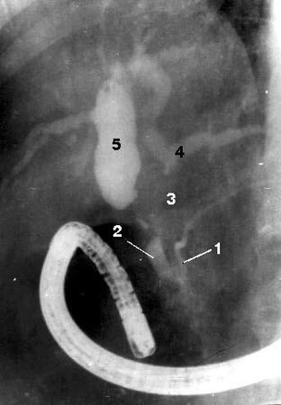 Коллектив авторов - Избранные лекции по факультетской хирургии: учебное пособие