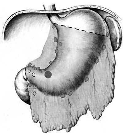 Коллектив авторов - Избранные лекции по факультетской хирургии: учебное пособие