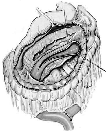 Коллектив авторов - Избранные лекции по факультетской хирургии: учебное пособие