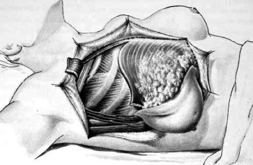 Коллектив авторов - Избранные лекции по факультетской хирургии: учебное пособие