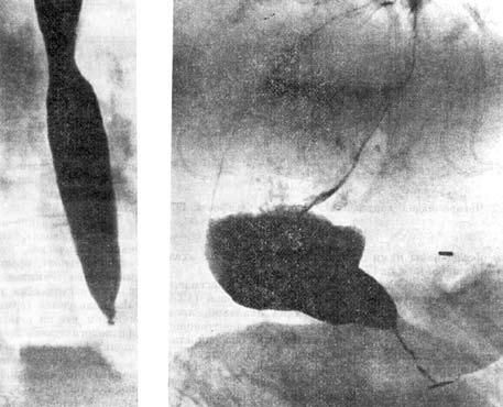 Коллектив авторов - Избранные лекции по факультетской хирургии: учебное пособие