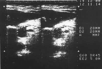 Коллектив авторов - Избранные лекции по факультетской хирургии: учебное пособие
