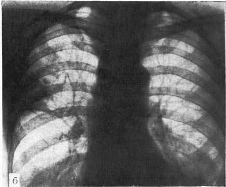 Коллектив авторов - Избранные лекции по факультетской хирургии: учебное пособие