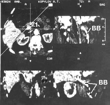Коллектив авторов - Избранные лекции по факультетской хирургии: учебное пособие