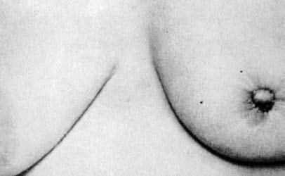 Коллектив авторов - Избранные лекции по факультетской хирургии: учебное пособие