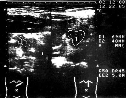 Коллектив авторов - Избранные лекции по факультетской хирургии: учебное пособие