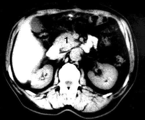 Коллектив авторов - Избранные лекции по факультетской хирургии: учебное пособие