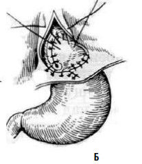 Коллектив авторов - Избранные лекции по факультетской хирургии: учебное пособие