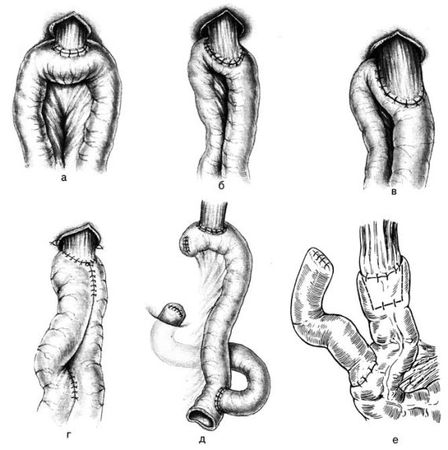 Коллектив авторов - Избранные лекции по факультетской хирургии: учебное пособие