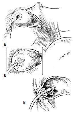 Коллектив авторов - Избранные лекции по факультетской хирургии: учебное пособие