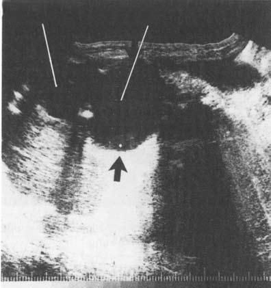 Коллектив авторов - Избранные лекции по факультетской хирургии: учебное пособие