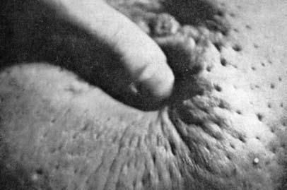 Коллектив авторов - Избранные лекции по факультетской хирургии: учебное пособие