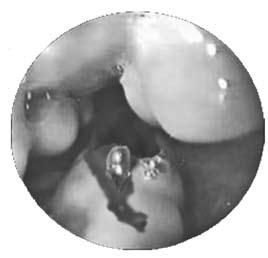 Коллектив авторов - Избранные лекции по факультетской хирургии: учебное пособие