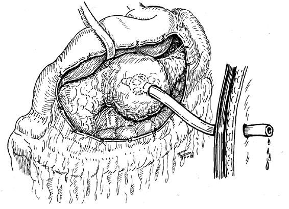 Коллектив авторов - Избранные лекции по факультетской хирургии: учебное пособие