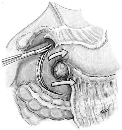 Коллектив авторов - Избранные лекции по факультетской хирургии: учебное пособие