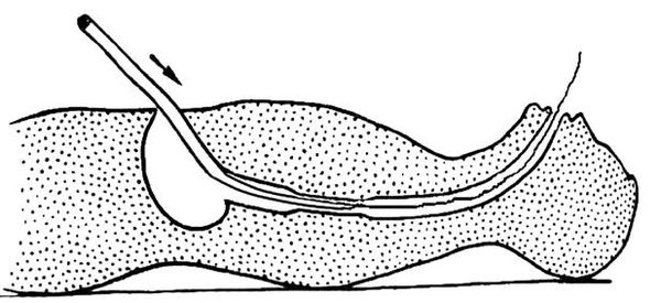 Коллектив авторов - Избранные лекции по факультетской хирургии: учебное пособие