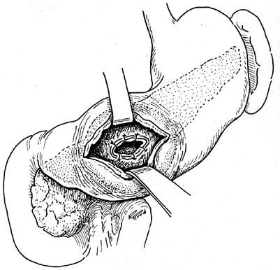 Коллектив авторов - Избранные лекции по факультетской хирургии: учебное пособие