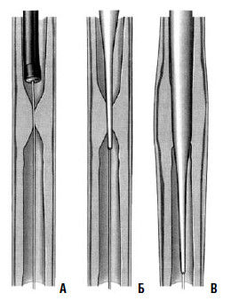 Коллектив авторов - Избранные лекции по факультетской хирургии: учебное пособие