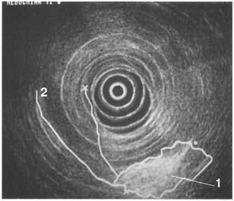 Коллектив авторов - Избранные лекции по факультетской хирургии: учебное пособие