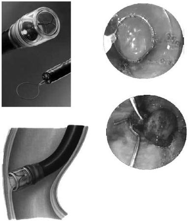 Коллектив авторов - Избранные лекции по факультетской хирургии: учебное пособие