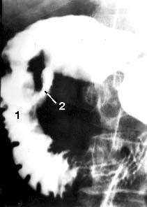 Коллектив авторов - Избранные лекции по факультетской хирургии: учебное пособие