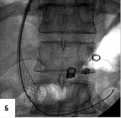 Коллектив авторов - Избранные лекции по факультетской хирургии: учебное пособие