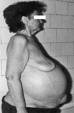 Коллектив авторов - Избранные лекции по факультетской хирургии: учебное пособие