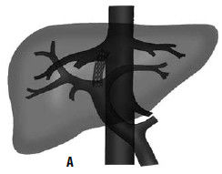 Коллектив авторов - Избранные лекции по факультетской хирургии: учебное пособие