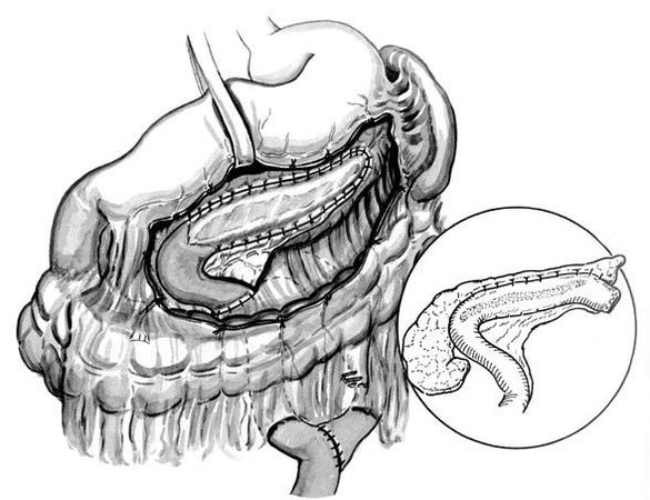 Коллектив авторов - Избранные лекции по факультетской хирургии: учебное пособие