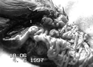 Коллектив авторов - Избранные лекции по факультетской хирургии: учебное пособие