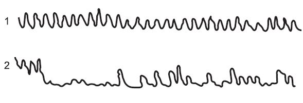 Леонид Дворкин - Подготовка юного тяжелоатлета