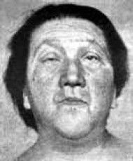 Леонид Рудницкий - Заболевания щитовидной железы: лечение и профилактика