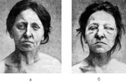 Леонид Рудницкий - Заболевания щитовидной железы: лечение и профилактика