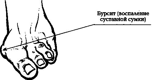 Павел Евдокименко - Артроз. Избавляемся от боли в суставах